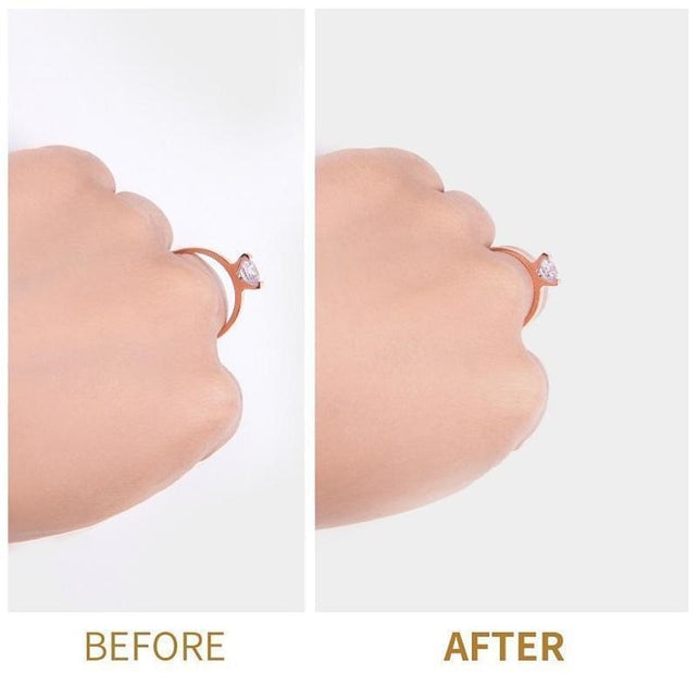 đ„ Ring Re-sizer Set