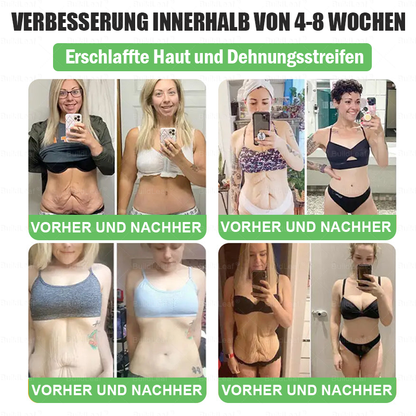 Klinisch erprobt | Offizieller Shop | 𝑩𝒖𝒊𝒍𝒅𝑳𝒆𝒂𝒇® 𝑩𝒆𝒓𝒃𝒆𝒓𝒊𝒏 & 𝑮𝑳𝑷-1 𝑷𝒓𝒐 𝑮𝒆𝒘𝒊𝒄𝒉𝒕𝒔𝒗𝒆𝒓𝒍𝒖𝒔𝒕 𝑶𝒓𝒂𝒍 𝑺𝒐𝒍𝒖𝒕𝒊𝒐𝒏 𝒁𝒊𝒆𝒍𝒕 𝒂𝒖𝒇 𝒉𝒂𝒓𝒕𝒏ä𝒄𝒌𝒊𝒈𝒆𝒔 𝑮𝒆𝒘𝒊𝒄𝒉𝒕, 𝑩𝒍𝒖𝒕𝒉𝒐𝒄𝒉𝒅𝒓𝒖𝒄𝒌, 𝒉𝒐𝒉𝒆𝒏 𝑩𝒍𝒖𝒕𝒛𝒖𝒄𝒌𝒆𝒓, 𝑭𝒆𝒕𝒕𝒍𝒆𝒃𝒆𝒓, 𝑮𝒆𝒍𝒆𝒏𝒌𝒔𝒄𝒉𝒎𝒆𝒓𝒛𝒆𝒏, 𝑬𝒏𝒆𝒓𝒈𝒊𝒆𝒎𝒂𝒏𝒈𝒆𝒍 𝒖𝒏𝒅 𝒔𝒄𝒉𝒍𝒂𝒇𝒇𝒆 𝑯𝒂𝒖𝒕