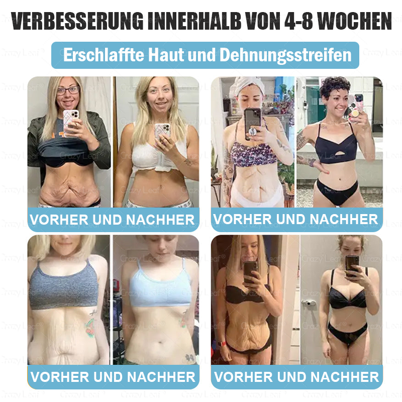 🇩🇪 𝑪𝒓𝒂𝒛𝒚𝑳𝒆𝒂𝒇® 𝑮𝑳𝑷-1 𝒐𝒓𝒂𝒍𝒆 𝑳ö𝒔𝒖𝒏𝒈 – 𝑯𝒊𝒍𝒇𝒕 𝒃𝒆𝒊𝒎 𝒔𝒄𝒉𝒏𝒆𝒍𝒍𝒆𝒏 𝑨𝒃𝒏𝒆𝒉𝒎𝒆𝒏!