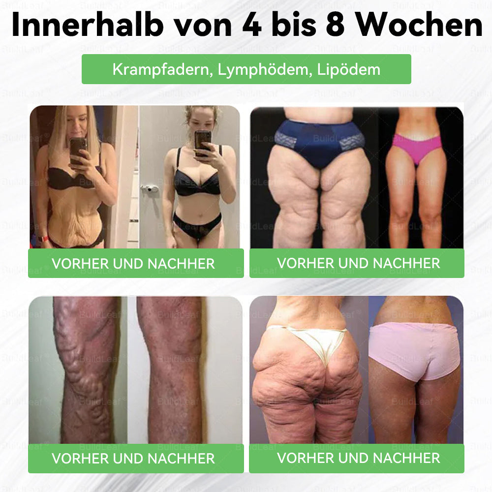 Klinisch erprobt | Offizieller Shop | 𝑩𝒖𝒊𝒍𝒅𝑳𝒆𝒂𝒇® 𝑩𝒆𝒓𝒃𝒆𝒓𝒊𝒏 & 𝑮𝑳𝑷-1 𝑷𝒓𝒐 𝑮𝒆𝒘𝒊𝒄𝒉𝒕𝒔𝒗𝒆𝒓𝒍𝒖𝒔𝒕 𝑶𝒓𝒂𝒍 𝑺𝒐𝒍𝒖𝒕𝒊𝒐𝒏 𝒁𝒊𝒆𝒍𝒕 𝒂𝒖𝒇 𝒉𝒂𝒓𝒕𝒏ä𝒄𝒌𝒊𝒈𝒆𝒔 𝑮𝒆𝒘𝒊𝒄𝒉𝒕, 𝑩𝒍𝒖𝒕𝒉𝒐𝒄𝒉𝒅𝒓𝒖𝒄𝒌, 𝒉𝒐𝒉𝒆𝒏 𝑩𝒍𝒖𝒕𝒛𝒖𝒄𝒌𝒆𝒓, 𝑭𝒆𝒕𝒕𝒍𝒆𝒃𝒆𝒓, 𝑮𝒆𝒍𝒆𝒏𝒌𝒔𝒄𝒉𝒎𝒆𝒓𝒛𝒆𝒏, 𝑬𝒏𝒆𝒓𝒈𝒊𝒆𝒎𝒂𝒏𝒈𝒆𝒍 𝒖𝒏𝒅 𝒔𝒄𝒉𝒍𝒂𝒇𝒇𝒆 𝑯𝒂𝒖𝒕