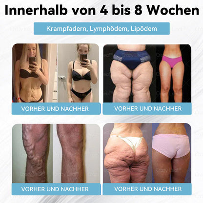 🇩🇪 𝑪𝒓𝒂𝒛𝒚𝑳𝒆𝒂𝒇® 𝑮𝑳𝑷-1 𝒐𝒓𝒂𝒍𝒆 𝑳ö𝒔𝒖𝒏𝒈 – 𝑯𝒊𝒍𝒇𝒕 𝒃𝒆𝒊𝒎 𝒔𝒄𝒉𝒏𝒆𝒍𝒍𝒆𝒏 𝑨𝒃𝒏𝒆𝒉𝒎𝒆𝒏!